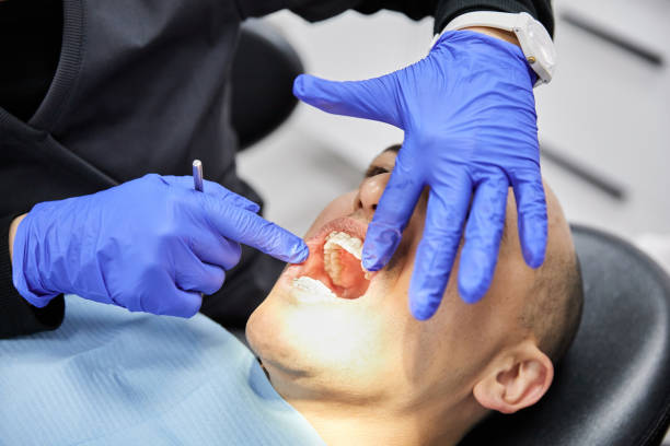 Best Emergency Dental Care for Broken or Chipped Teeth in Caledonia, WI