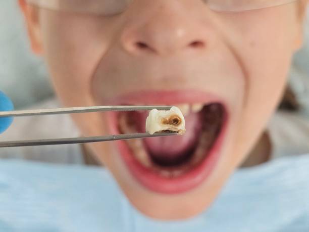 Best Pediatric Emergency Dentist in Caledonia, WI